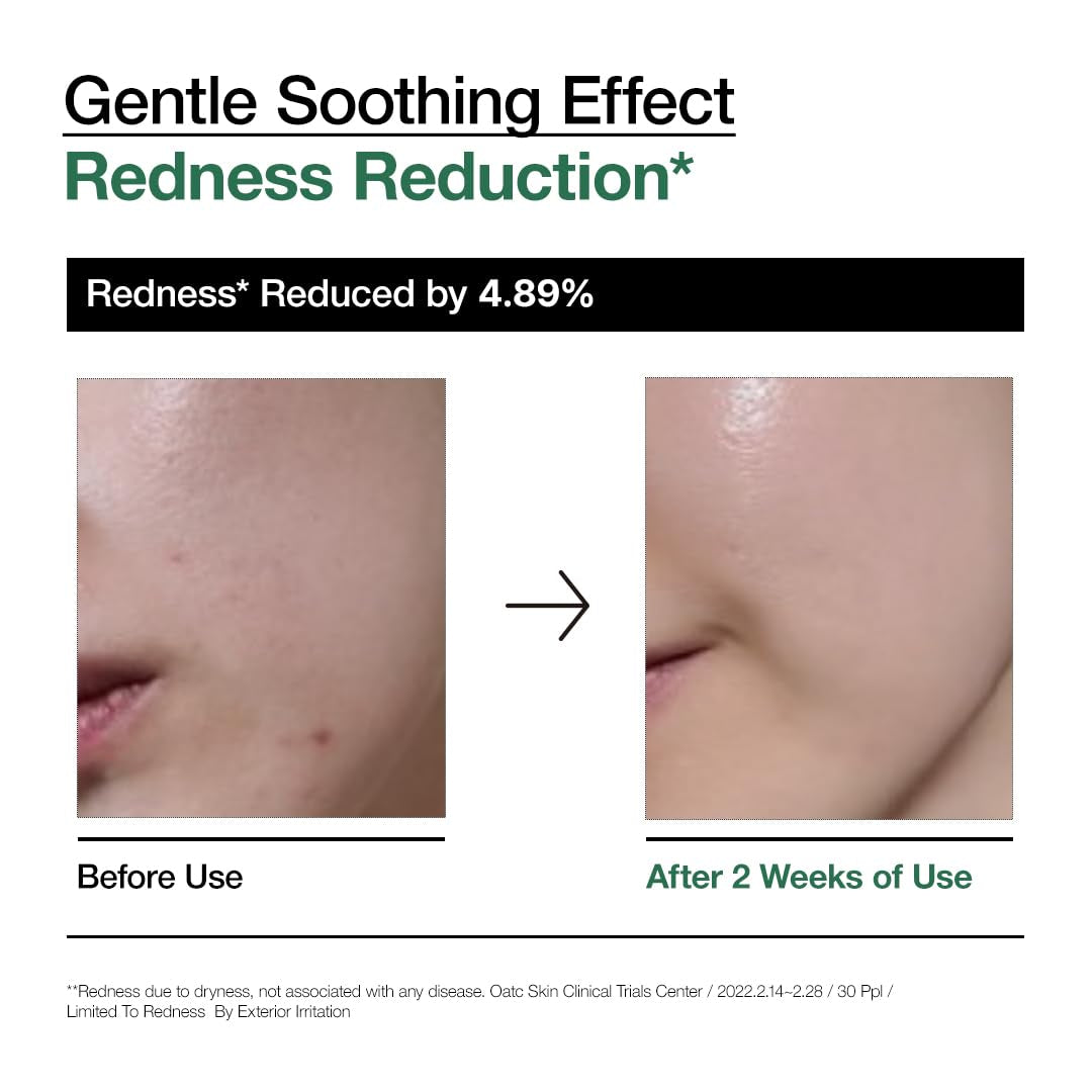 Heartleaf 80 Soothing Ampoule, Hydration Facial Serum for Glass Skin, Panthenol, Hyaluronic Acid, Non-Greasy, Gentle Formula, Lightweight Essence, Vegan, Korean Skin Care, 30Ml/1.01 Fl.Oz