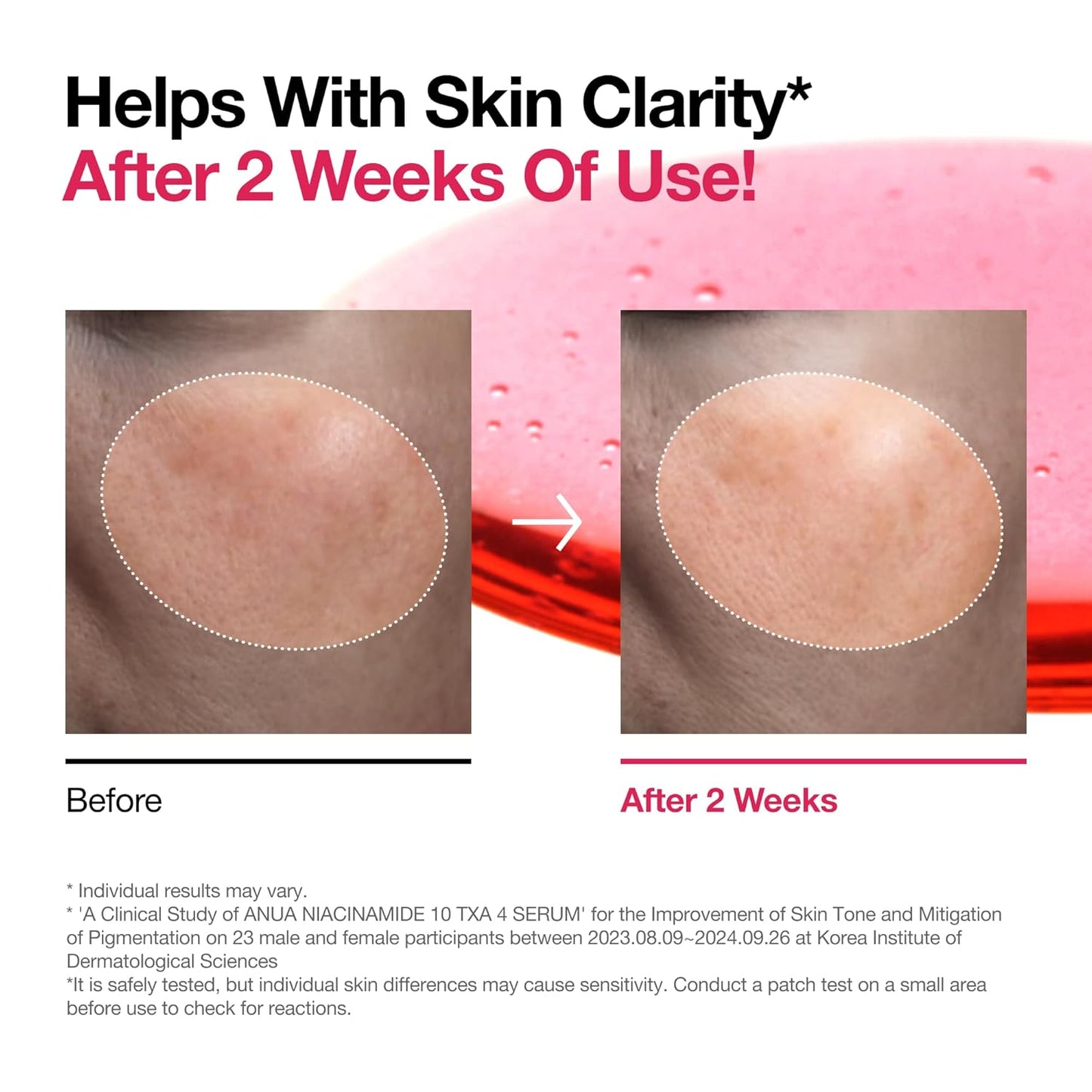 Niacinamide 10 + TXA 4 Serum, Hyaluronic Acid, Tranexamic Acid, Facial Serum for Glassskin, Glow Back Serum, Dark Spot Care, Postnatal Skincare, Korean Skincare (30Ml/1.01 Fl.Oz)